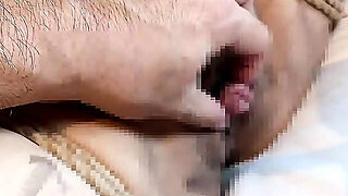 I Aspirate M Woman Clitoris And Am Fixed With Rubber