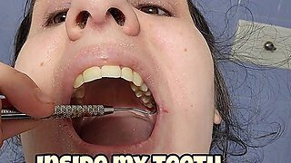 Dental Mirror And Hook Teeth Inspection Fetish, Exploring My Mouth And Showing Every Tooth Close-Up