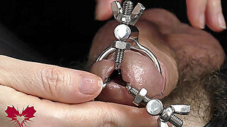 Dilation Of The Hole Expanded Glans And Sperm Blockage Through Urethral Insertion Of The Finger - Cl