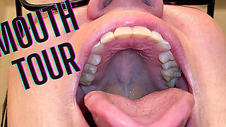 Mouth Tour With A Bottom Retainer