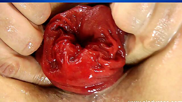 Sindy Rose Self Anal Fisting &Amp; Ruined Asshole Prolapse
